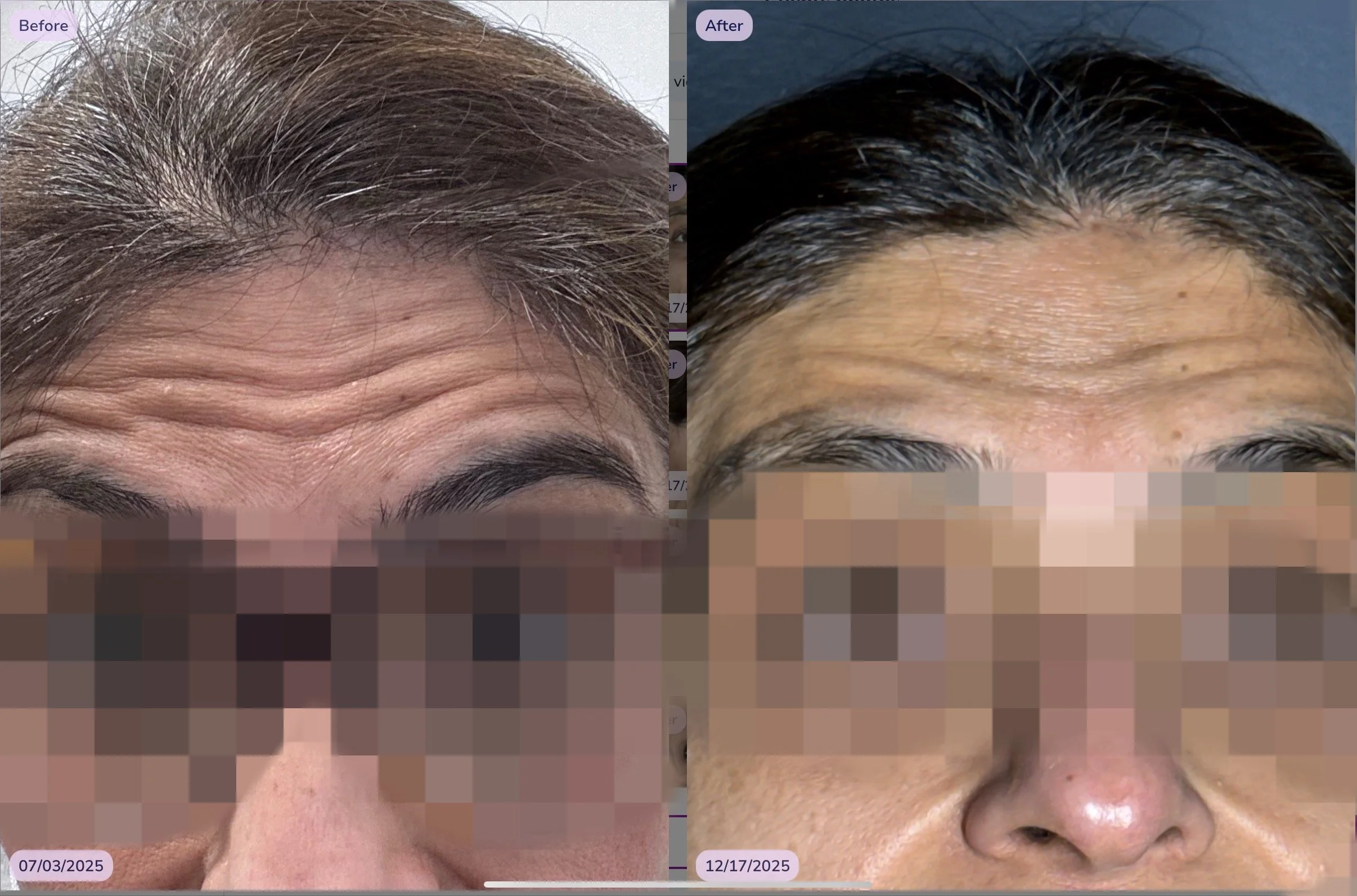 TOX after 4 months .jpeg