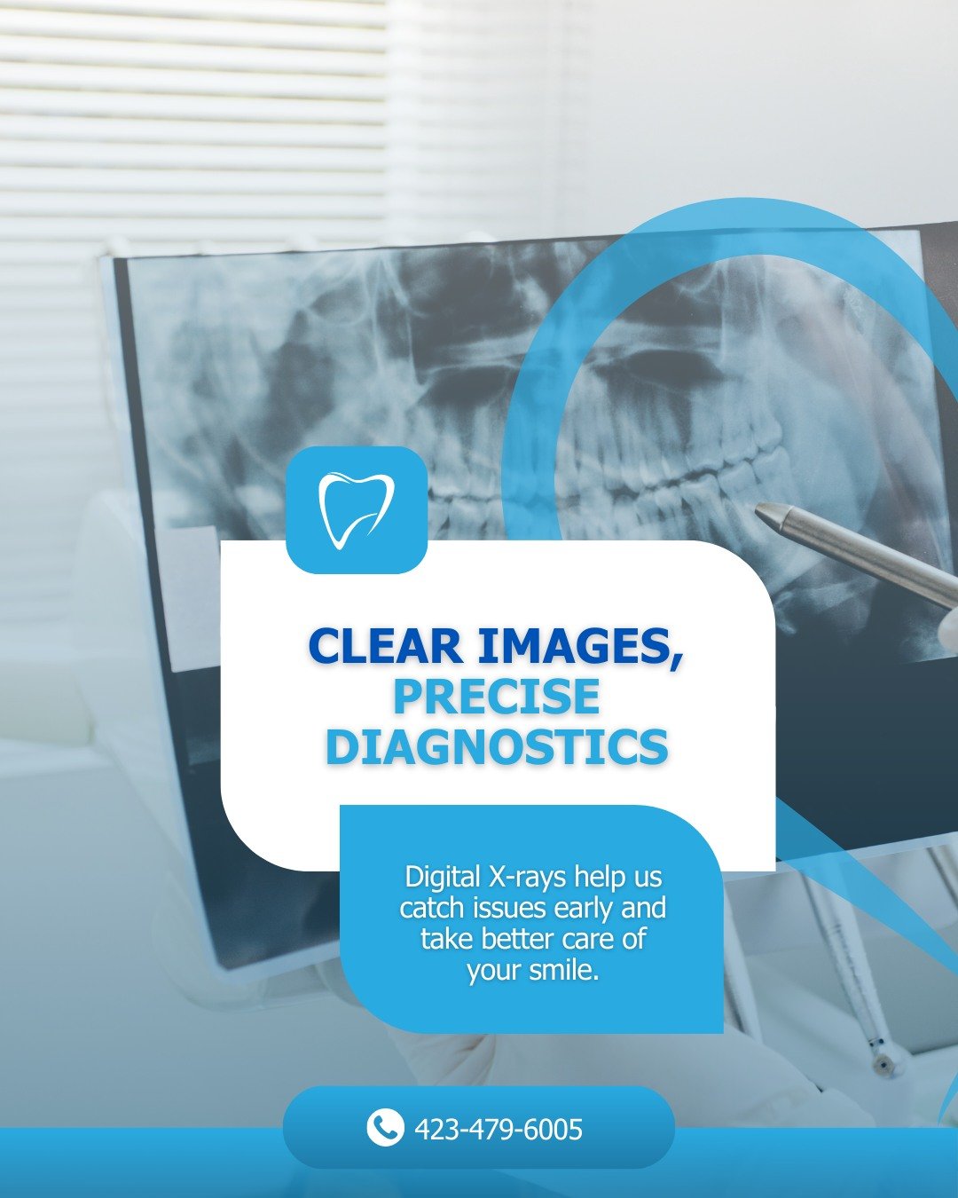 🦷Clear images for precise diagnostics.
Our digital technology helps us detect issues early and care for your smile with confidence.