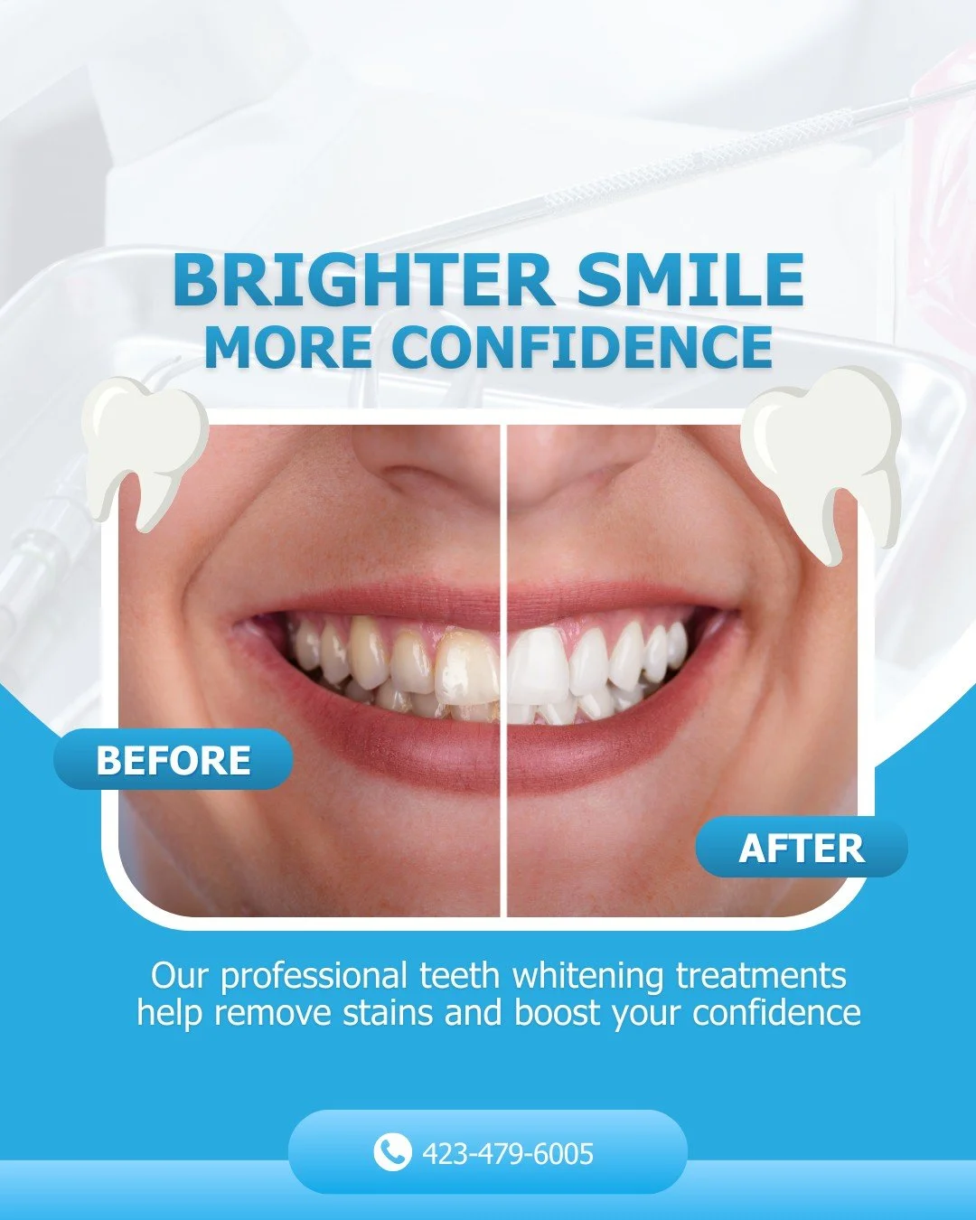 A brighter smile can make a big difference ✨
Our professional teeth whitening treatments help remove stains and boost your confidence.
Call us to schedule your appointment!