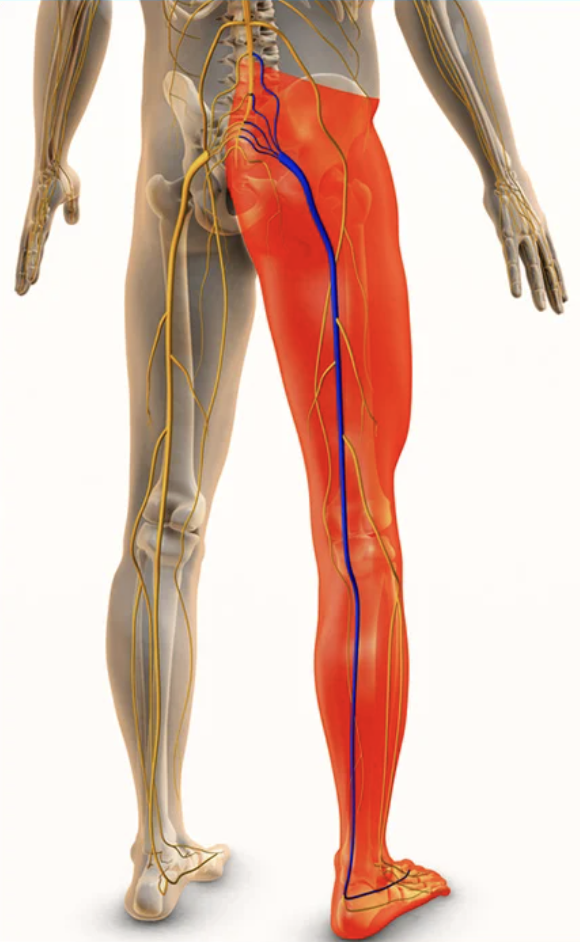 Sciatic Pain: What It Is (and What It Isn’t)