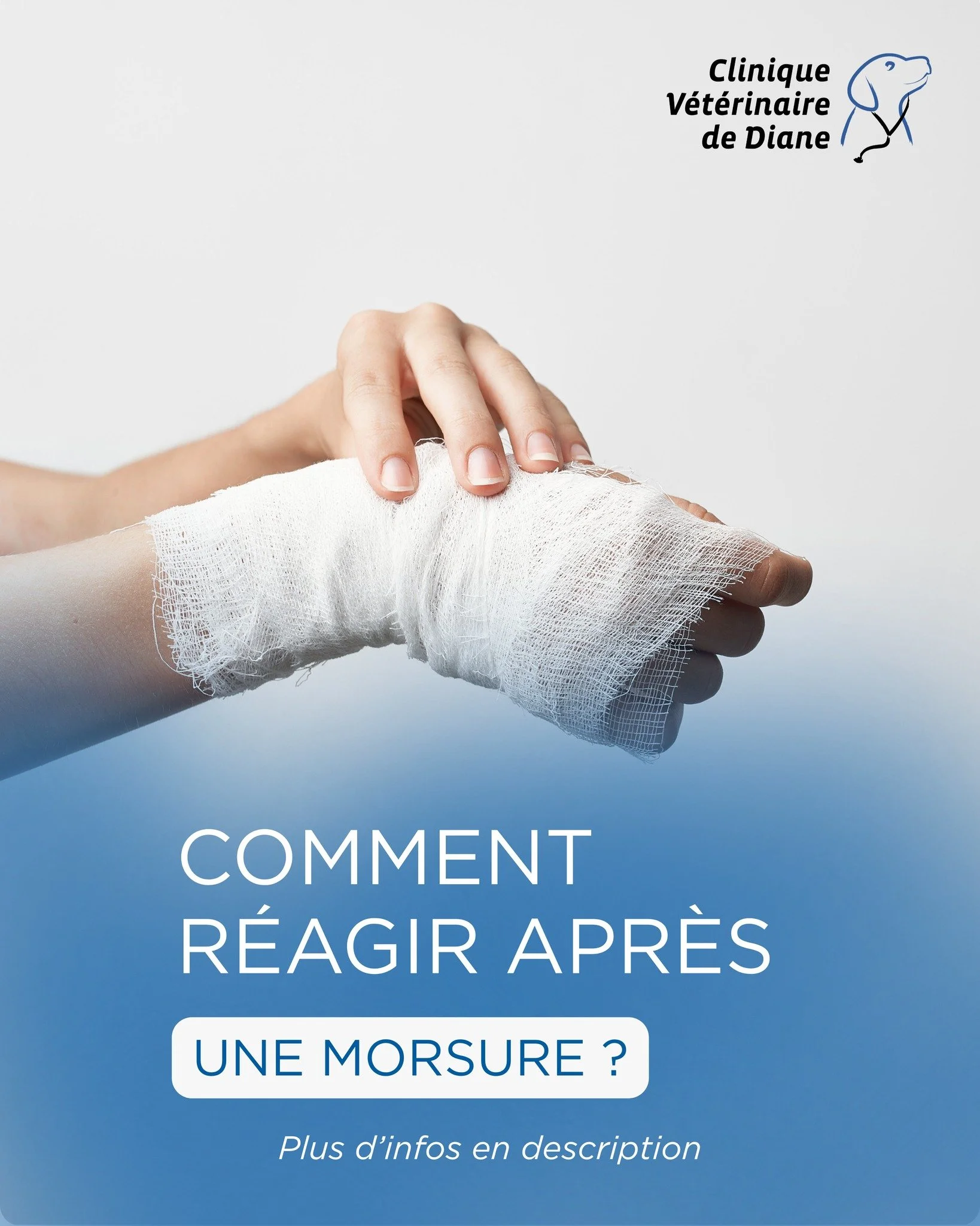 🐾 Votre chien a mordu : que faire ?

Pas de panique &mdash; il existe un protocole clair pour prot&eacute;ger la personne bless&eacute;e et votre compagnon 🐶

1️⃣ Consultez imm&eacute;diatement un m&eacute;decin ou un service d&rsquo;urgence (m&eac