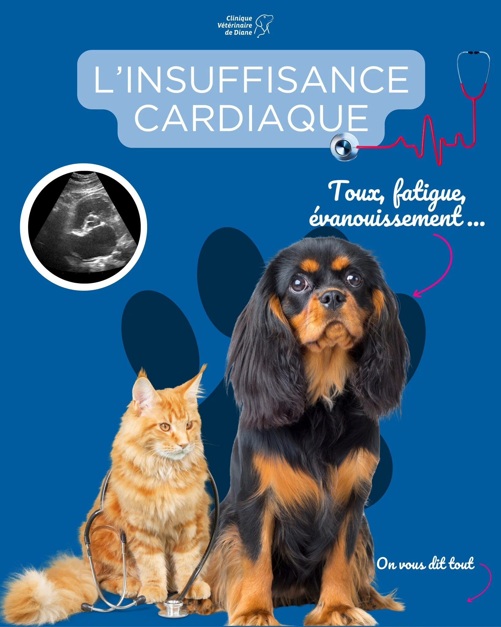 Souffle cardiaque : quand l&rsquo;&eacute;chographie cardiaque aide &agrave; &eacute;tablir un diagnostic 🫀

🩺 Lors de l&rsquo;auscultation, il est parfois possible de d&eacute;tecter un souffle cardiaque, c&rsquo;est-&agrave;-dire un bruit anormal