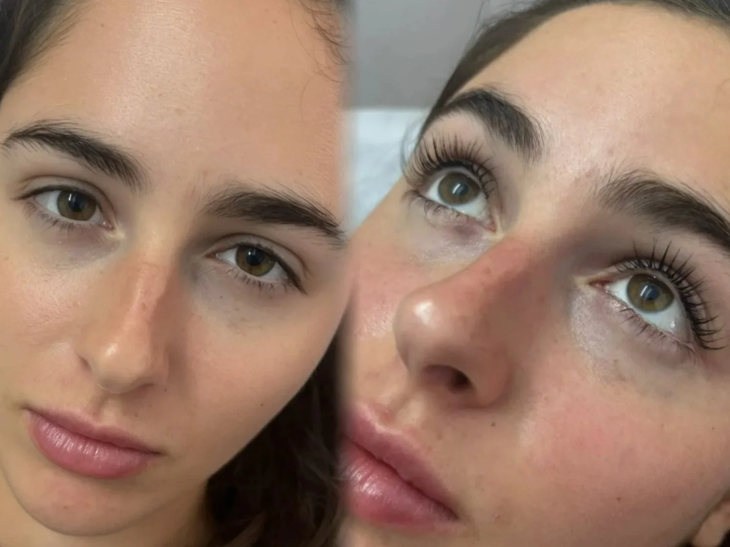 lifting Tenerife