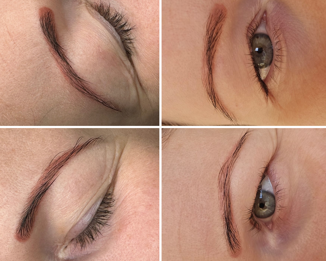 Eliminar Micropigmentacion