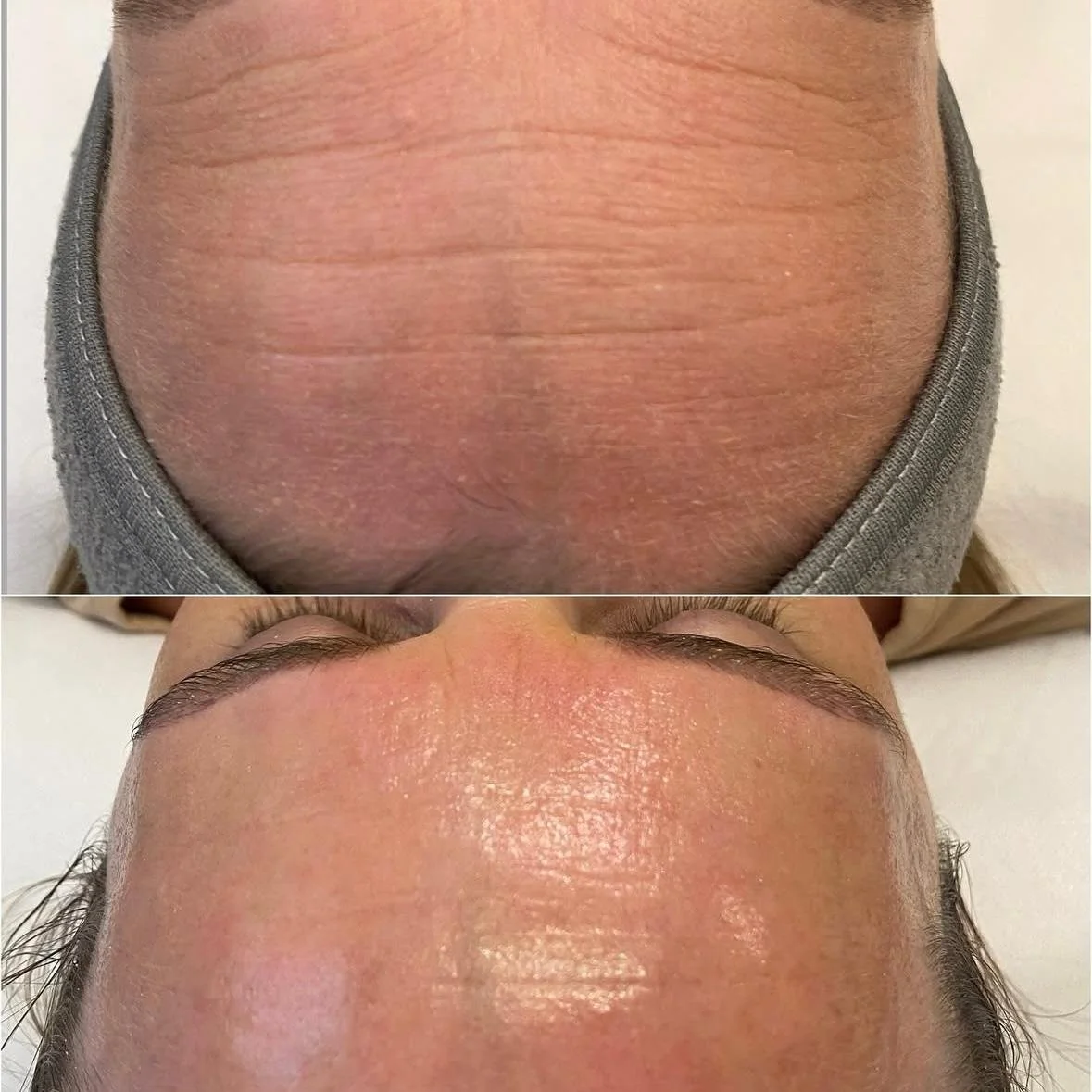 sin arrugas Tenerife