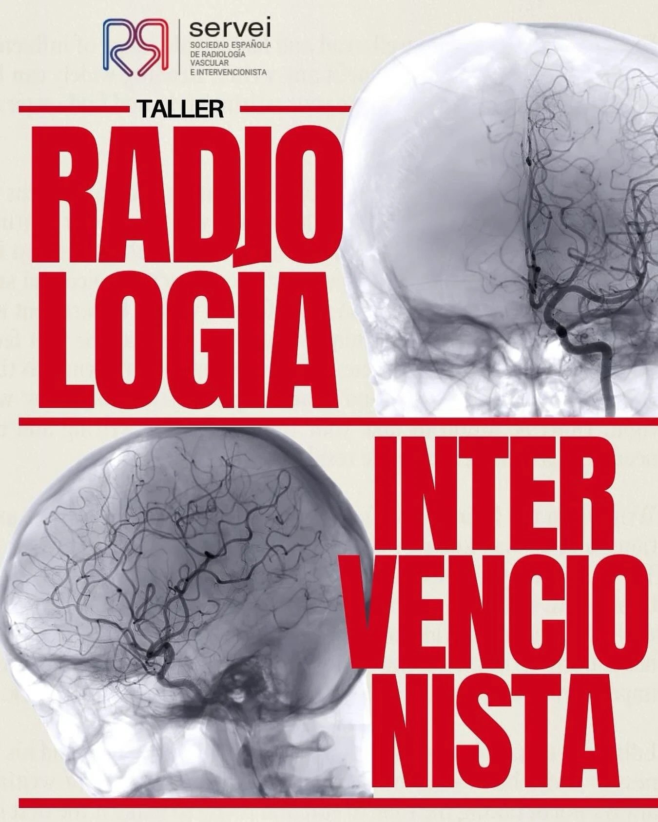 🔬✨ &iexcl;Os presentamos el Taller de Radiolog&iacute;a Intervencionista y An&aacute;lisis de Postprocesos, liderado por la Sociedad Espa&ntilde;ola de Radiolog&iacute;a Vascular e Intervencionista! ✨🔬

Descubre la radiolog&iacute;a como especialid