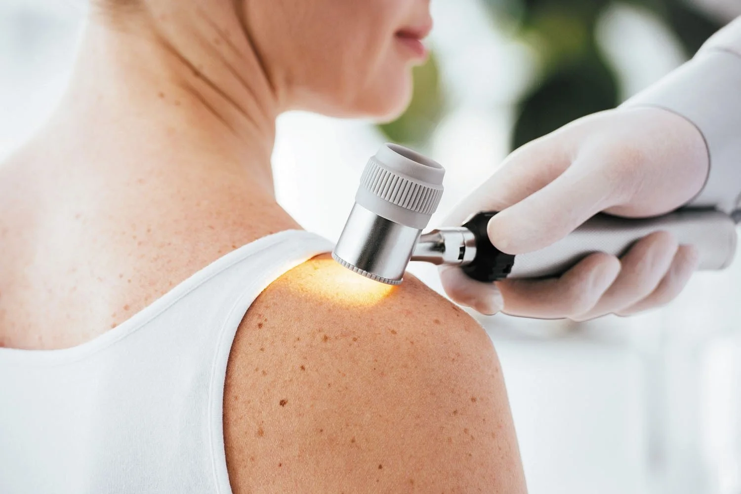 belfarm-screening-dermatologico-dermatoscopio.jpg