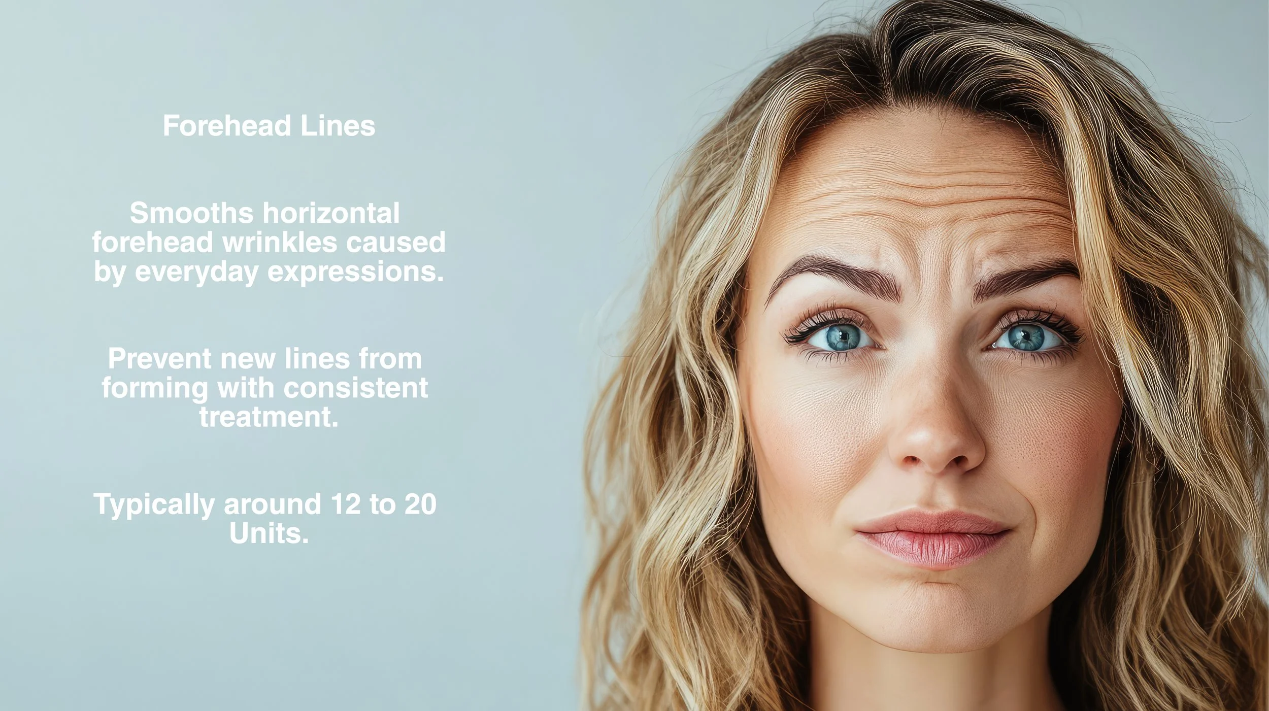 Botox for Forehead lines