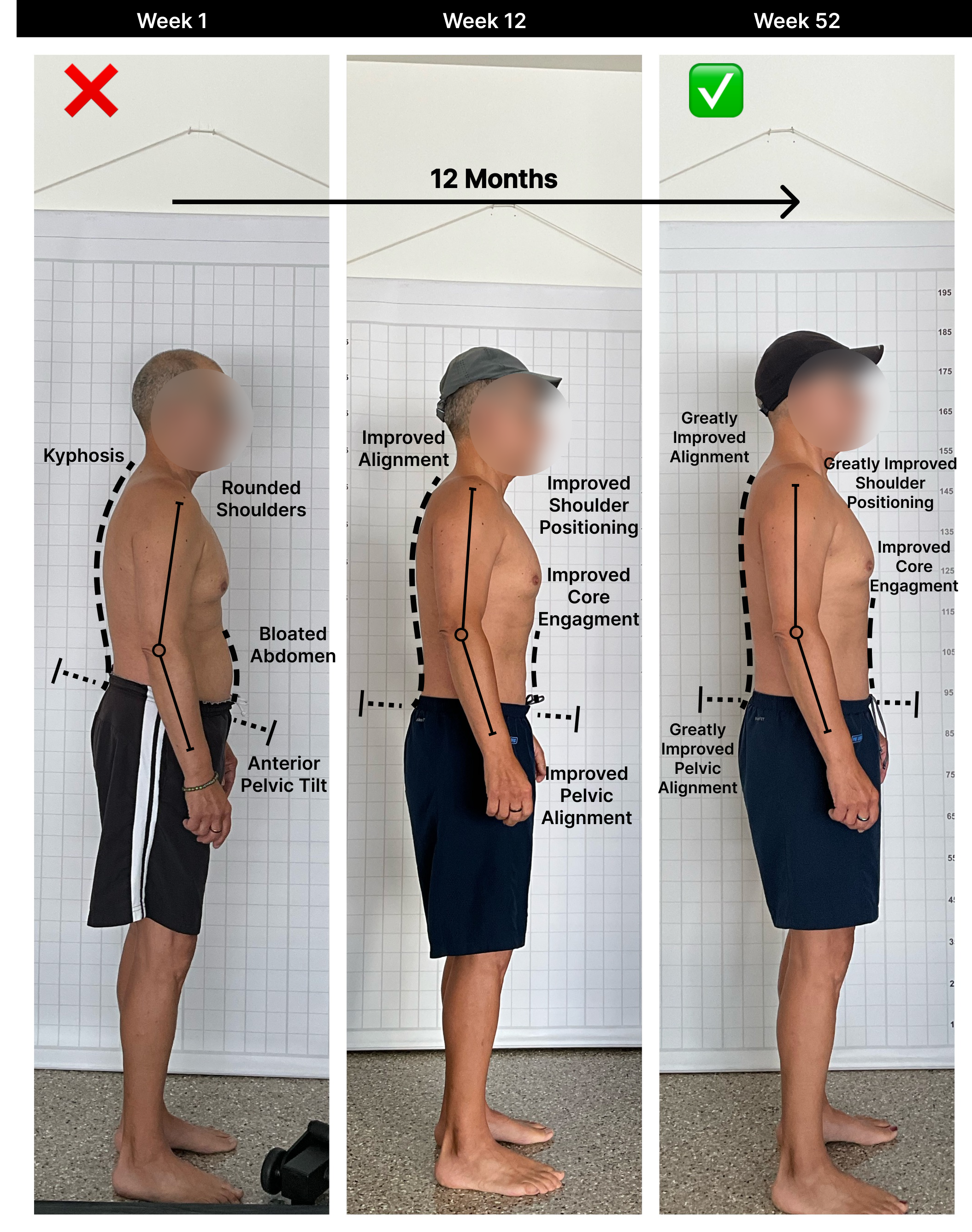 Jon - 12 Month [Lateral].png