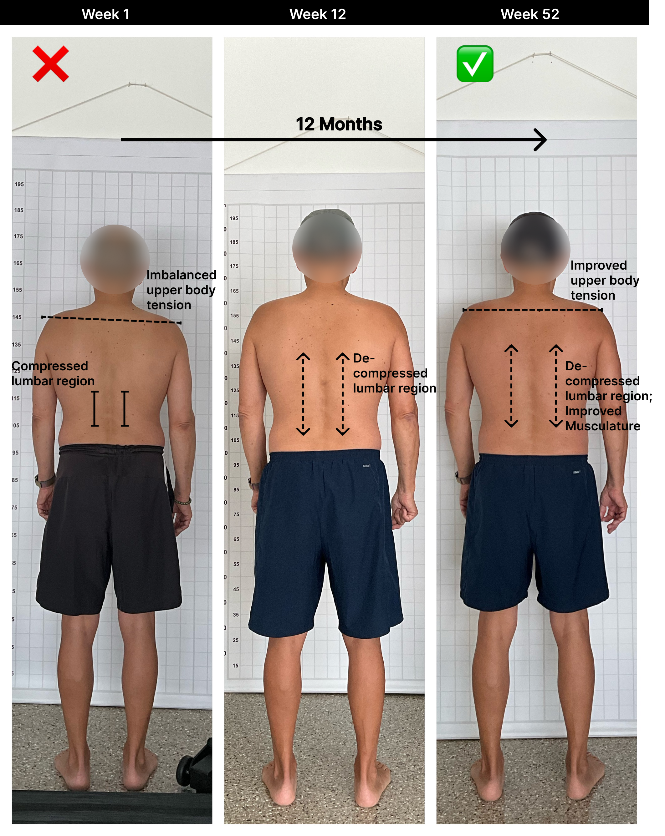 Jon - 12 Month [Posterior].png