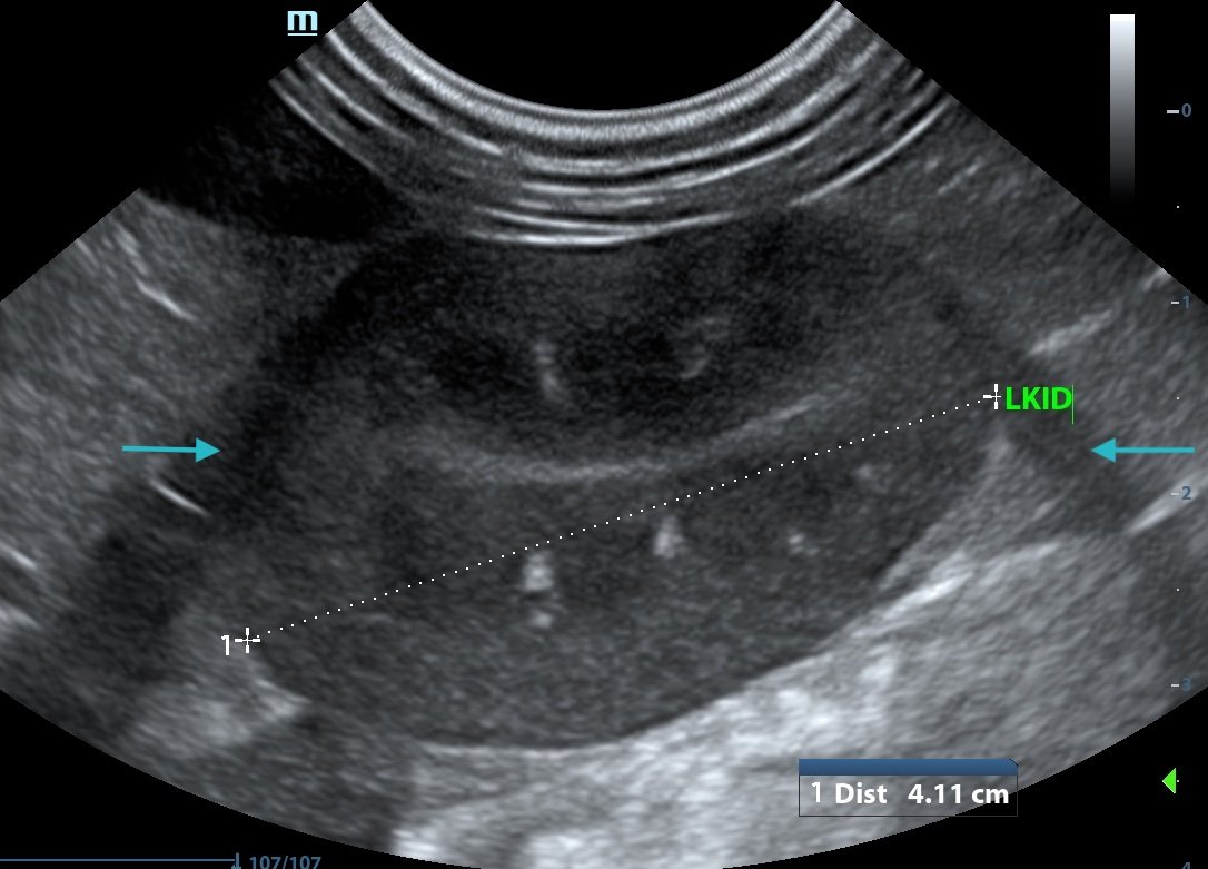 Pathology or Artifact?