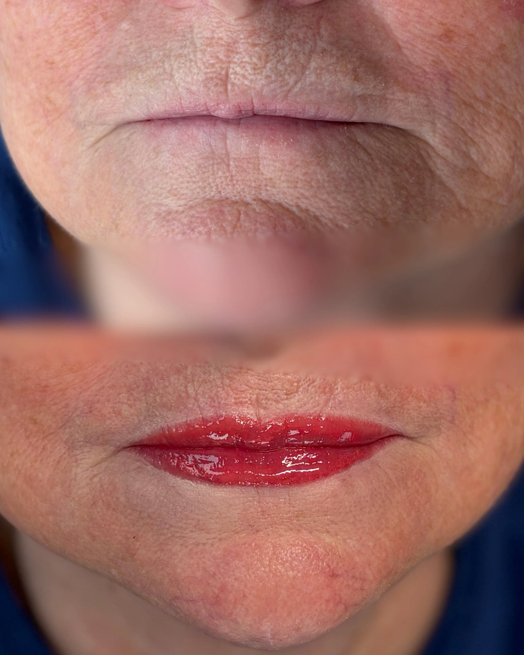 before and after close up of a elderly lady with a lip blush procedure