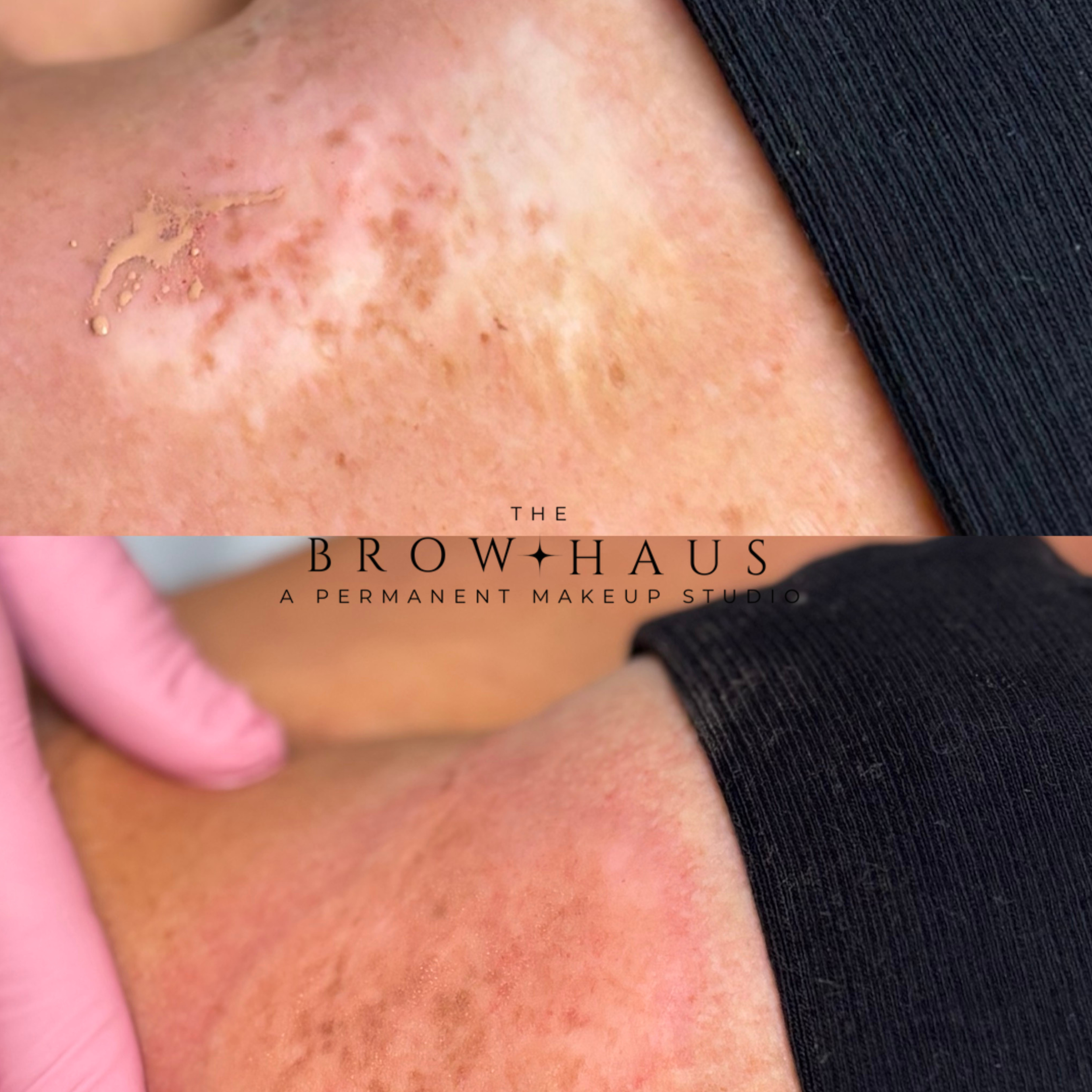 Comparison photo showing skin with age spots or pigmentation before and after treatment at The Brow Haus, a permanent makeup studio.
