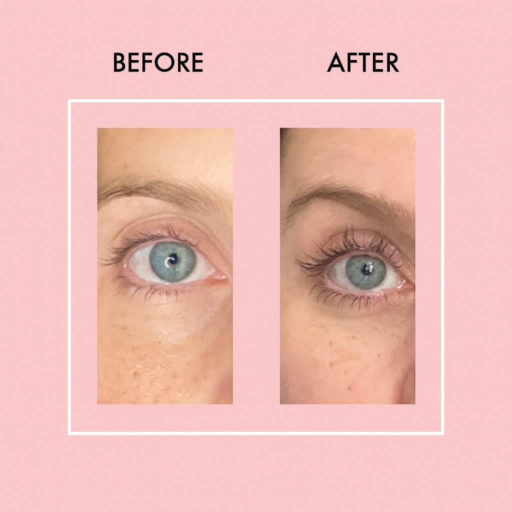 WOW ✨ LOOK AT THIS GROWTH!
These are REAL LashLab results after just a few weeks &mdash; longer, thicker, fuller lashes that speak for themselves.

Our powerful LashLab Lash Serum is made to:
✨ Grow noticeably longer lashes
✨ Thicken your lash line f