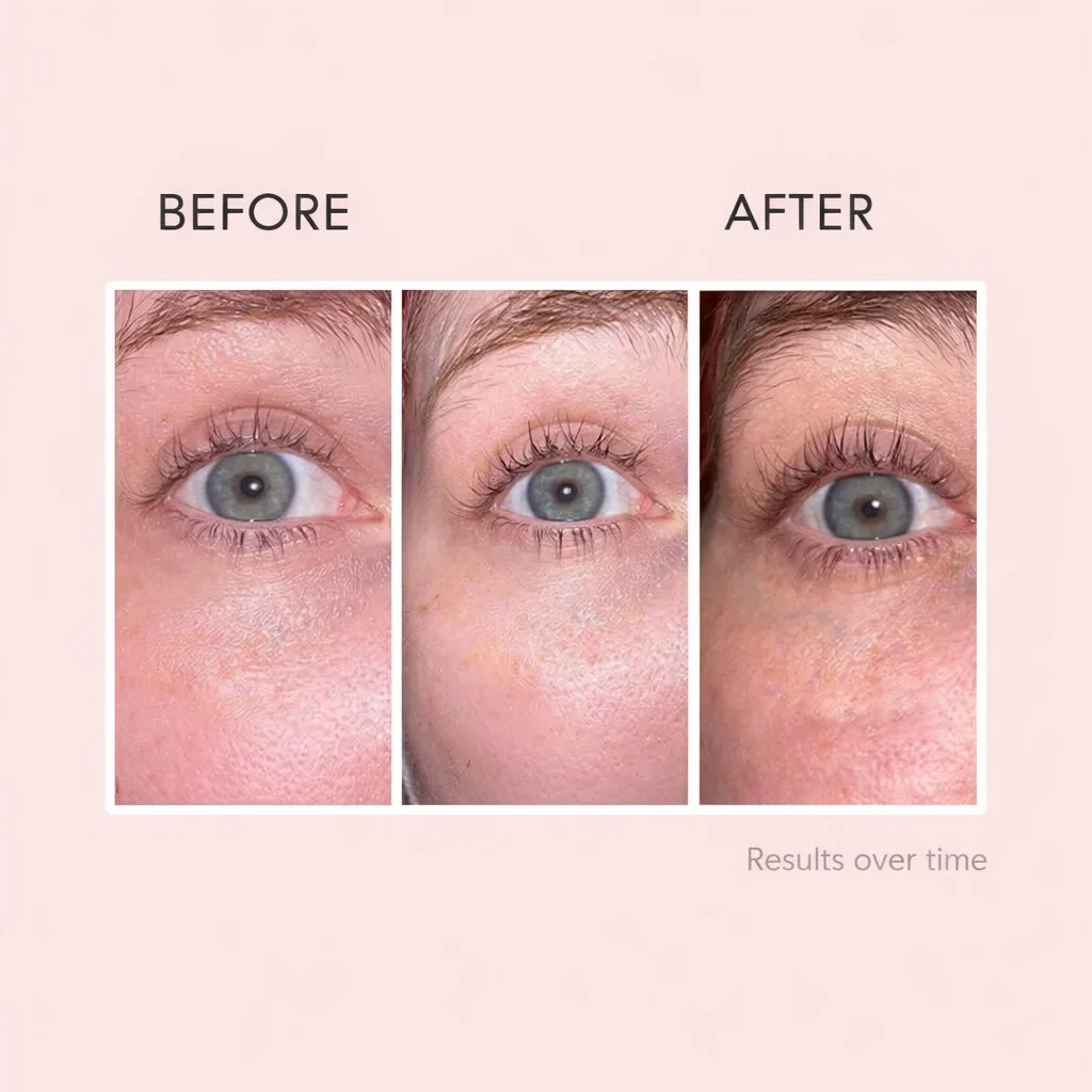Real results don&rsquo;t happen overnight ✨

Lash growth is a cycle &mdash; and this is exactly why Lashlab works so well.
✔️ Stronger lashes
✔️ Longer lashes
✔️ Healthier growth over time

Consistency is key. Stick with it and trust the process 🤍

