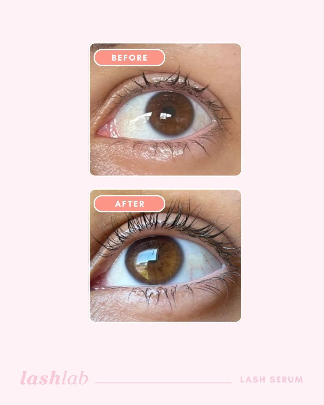 Before ➡️ After 

Thin, brittle lashes? Not anymore. Just weeks of consistent use with our Lash Serum and the results speak for themselves...fuller, longer, and healthier lashes you'll love.
.
.
.
.
#lashlab #lashserum #lashlength #growlashes