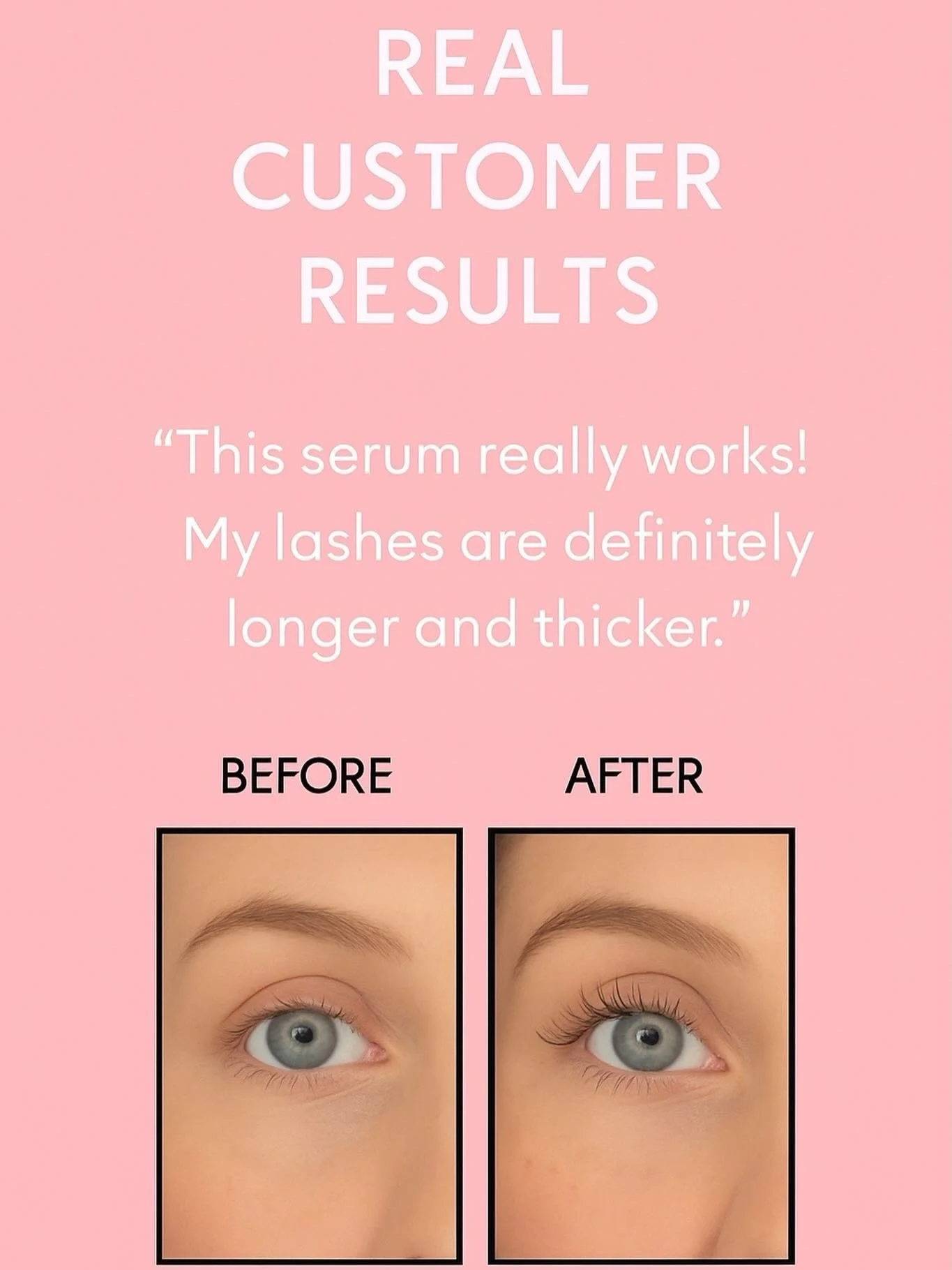 REAL CUSTOMER RESULTS 🤍
Longer, fuller, stronger lashes in just weeks.
Your lash transformation starts here.