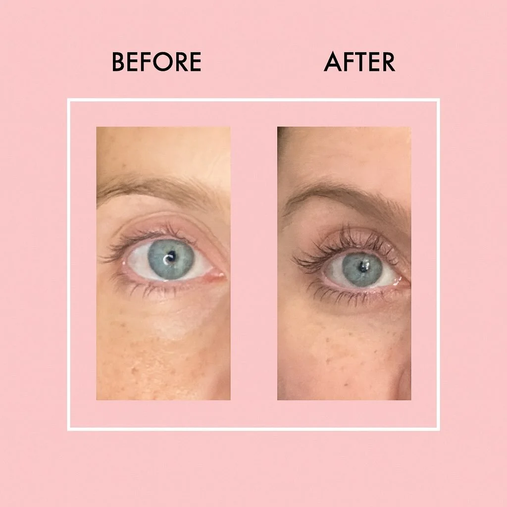 WOW ✨ LOOK AT THIS GROWTH!
These are REAL LashLab results after just a few weeks &mdash; longer, thicker, fuller lashes that speak for themselves.

Our powerful LashLab Lash Serum is made to:
✨ Grow noticeably longer lashes
✨ Thicken your lash line f