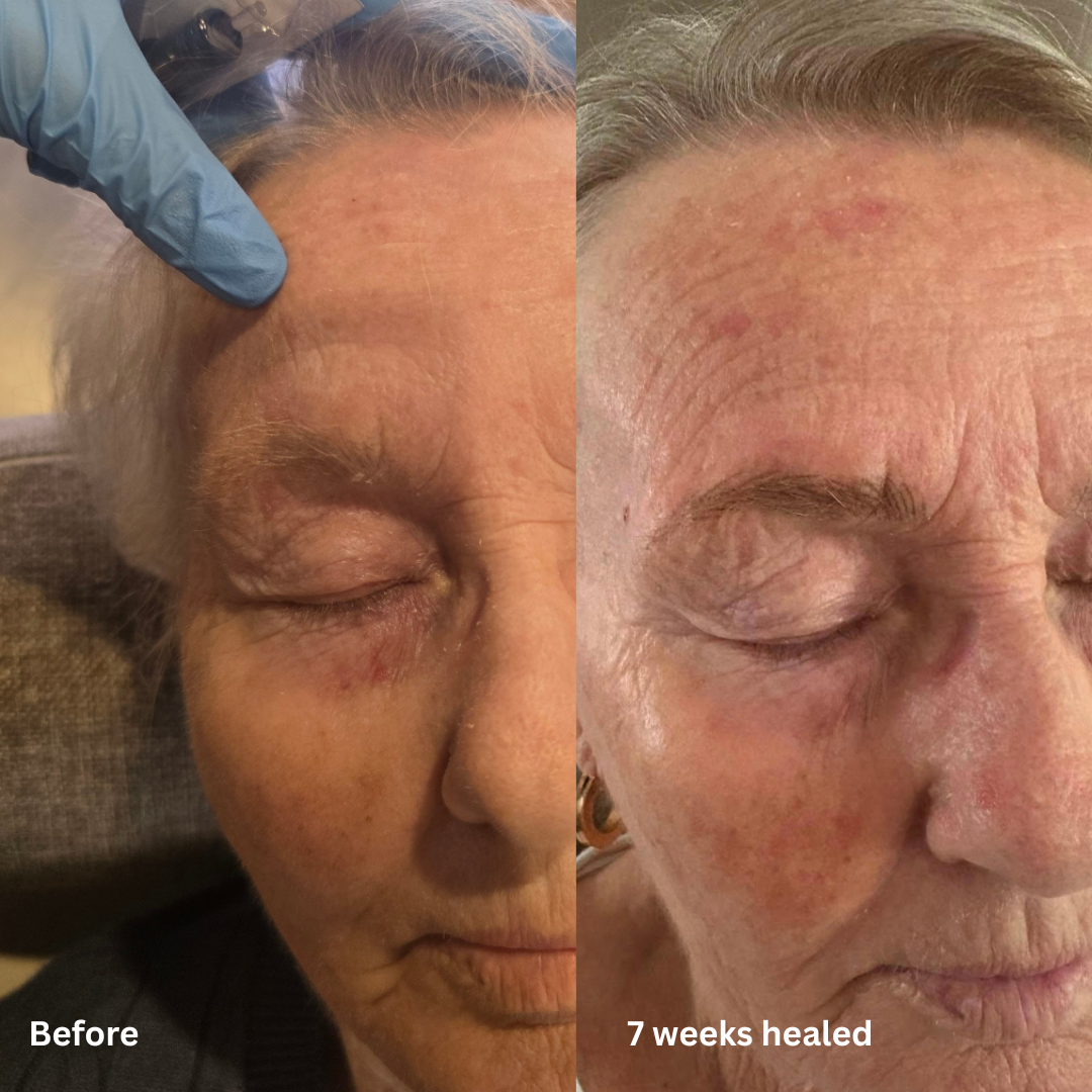Mature Skin SPMU: A Natural Hairstroke Brow Journey