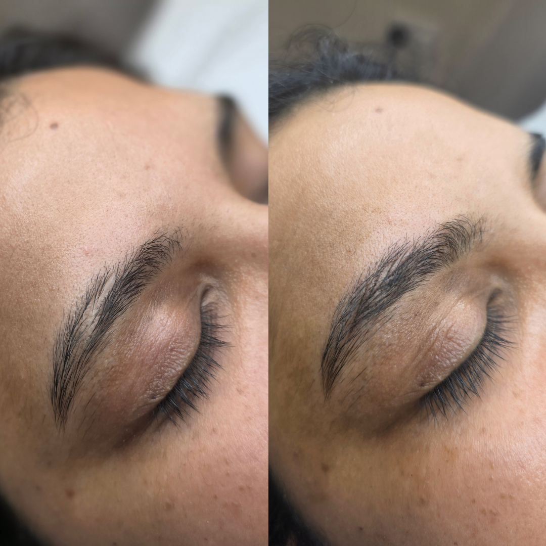 Small section of a scar cover up using machine hairstrokes in Bristol