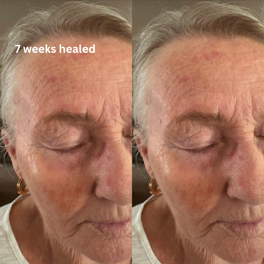 nano brows/machine hairstrokes healed results on mature skin from semi-permanent makeup treatment