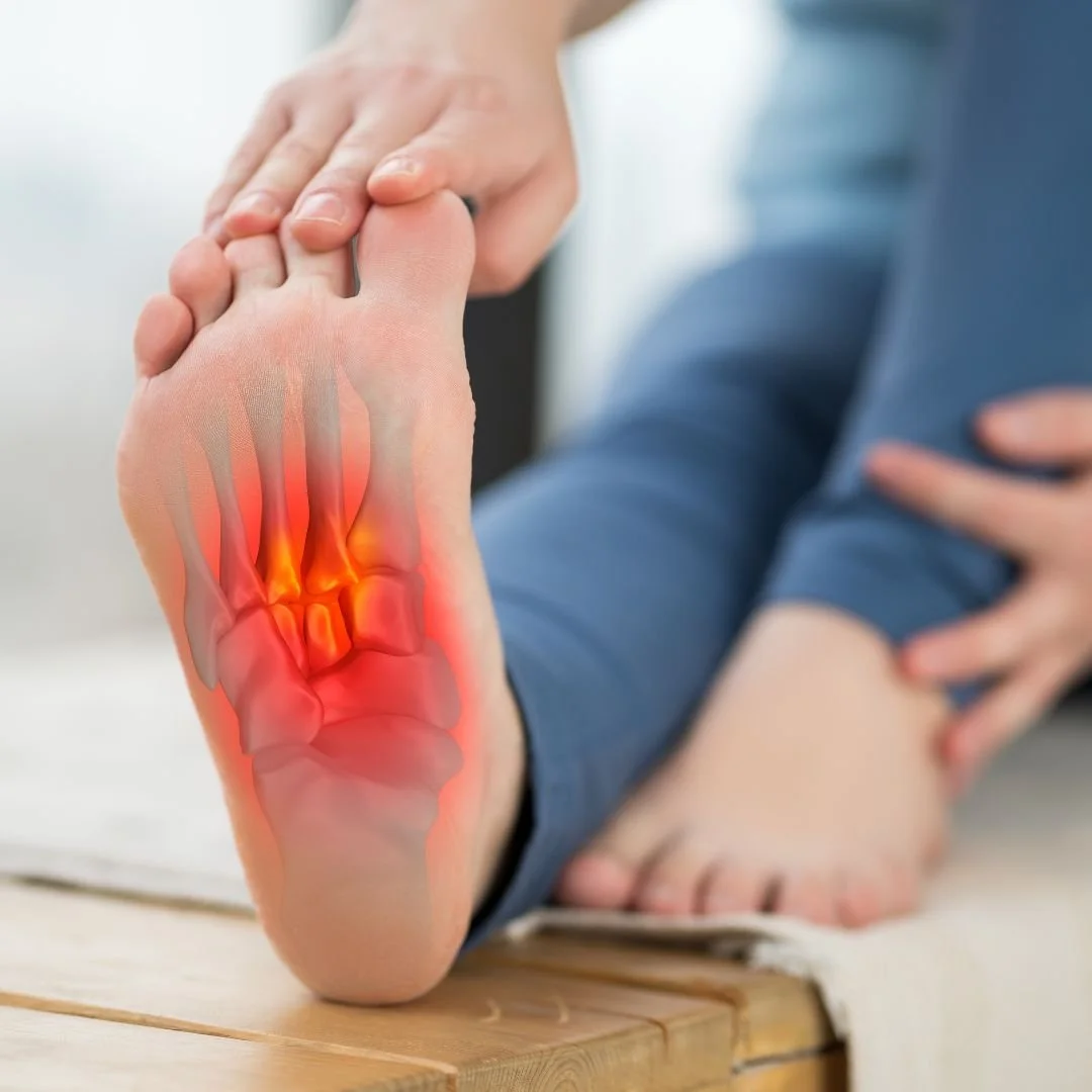 Fasciopatia plantare: quando il dolore sotto il piede non è solo “un’infiammazione”