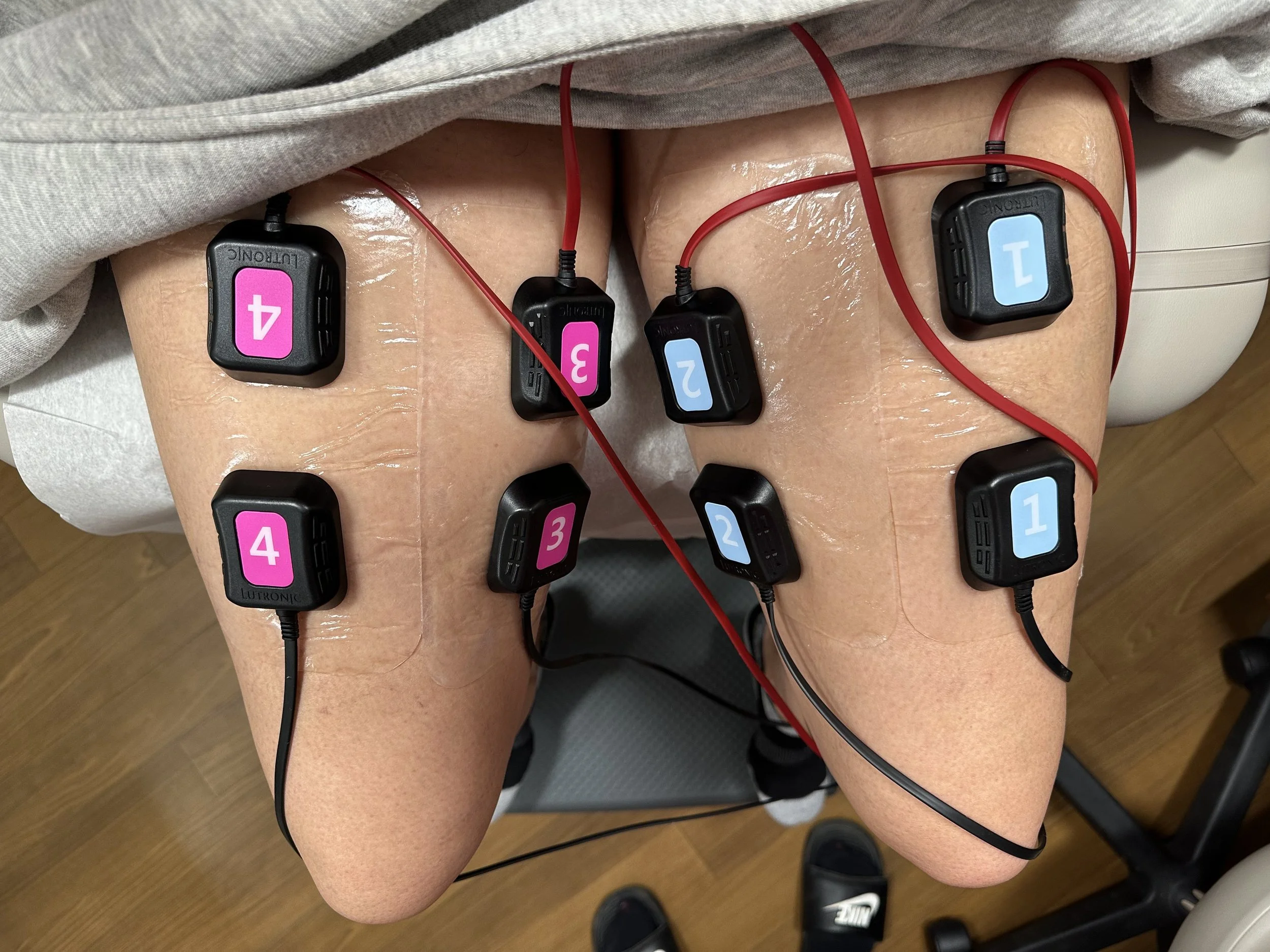 Accufit Body Sculpting: How Does Electrical Muscle Stimulation Actually Work?