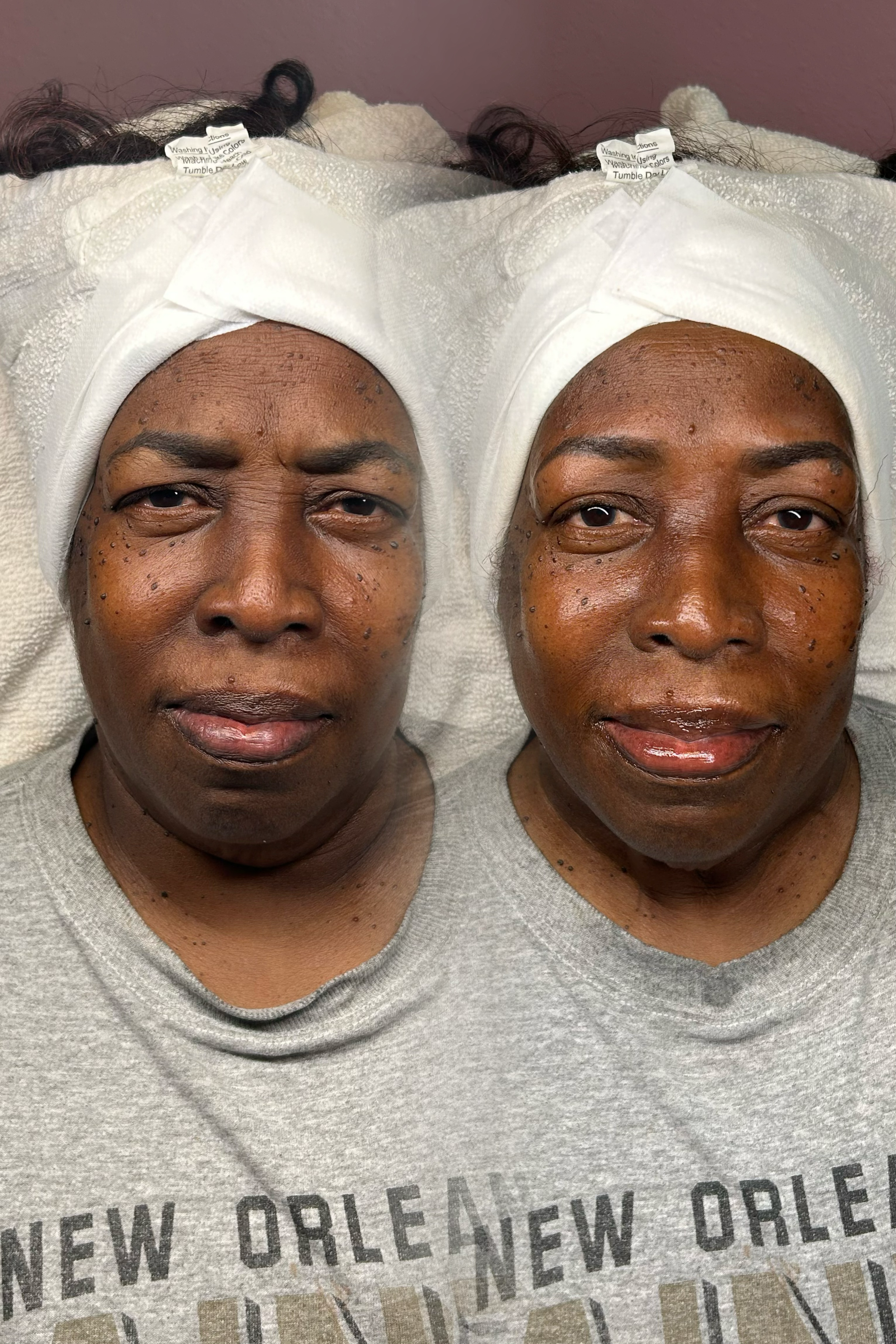 Helaed Ombre' Brows & Custom Facial