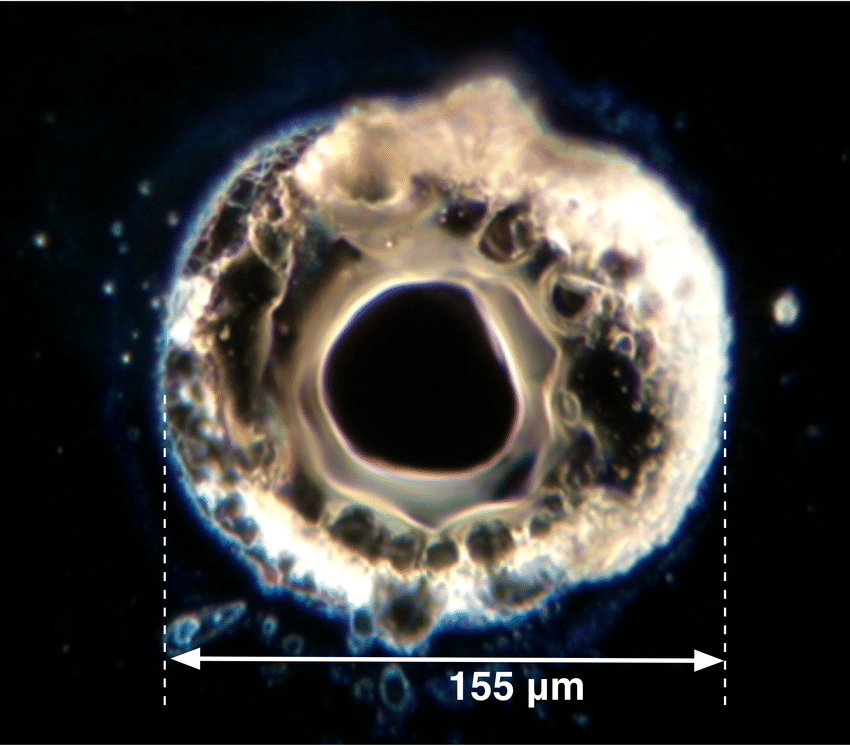 Dark-field microscope image of a point absorber on an Advanced LIGO optic