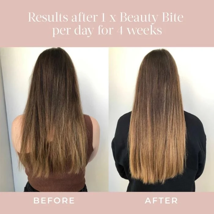 Beauty Bites®Before and After.jpg