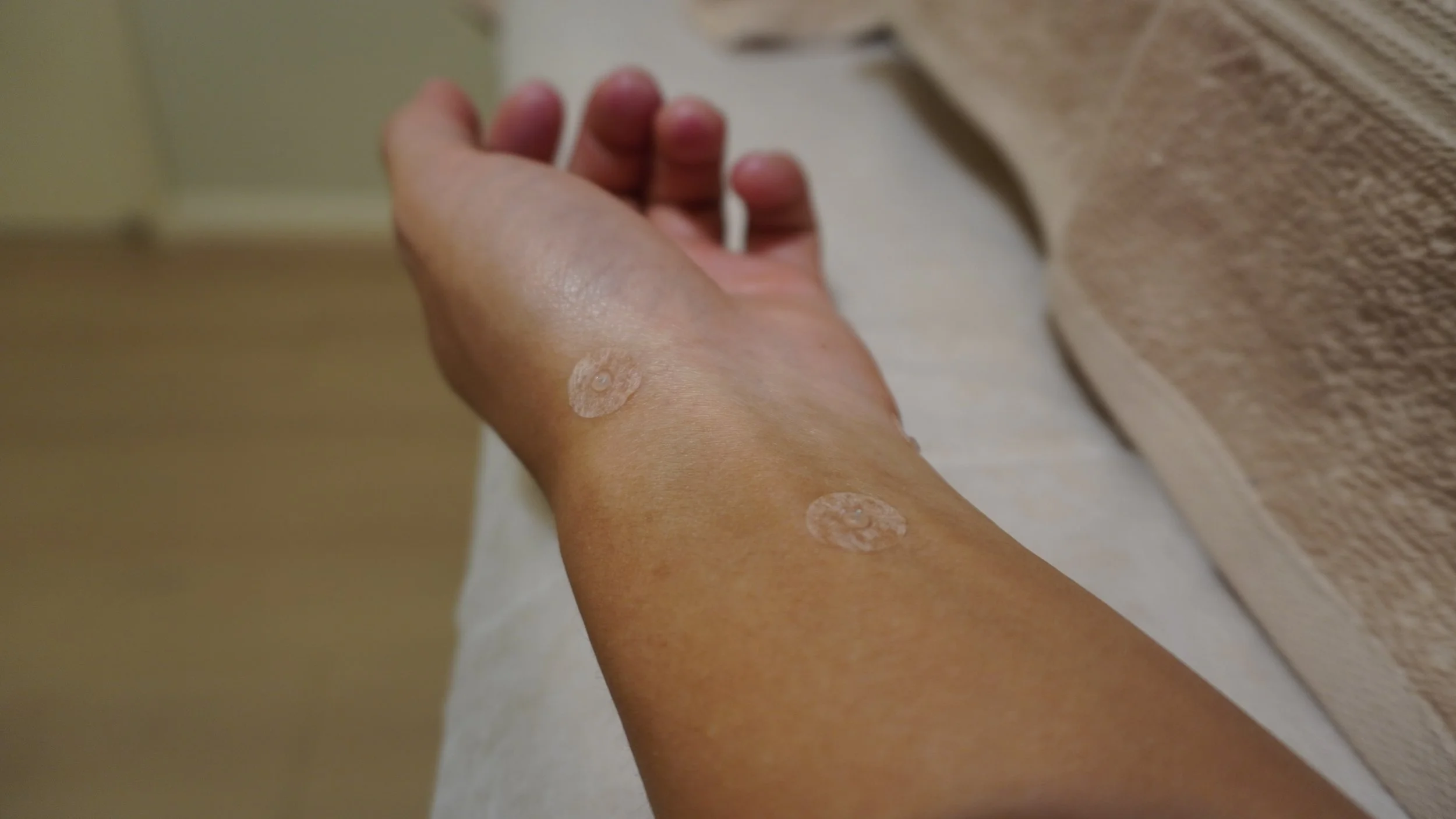 A person's arm with two adhesive bandages.