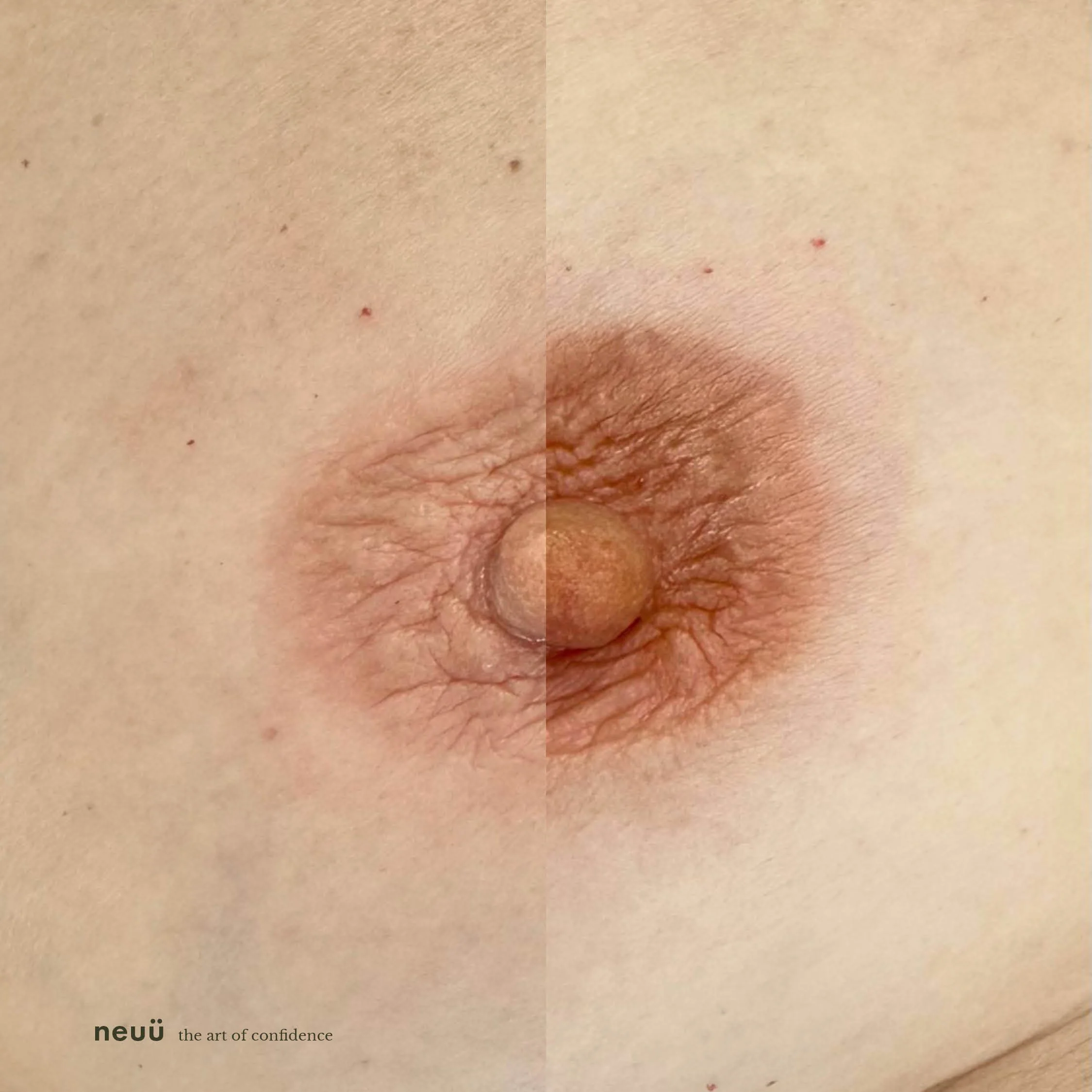 Areola and Nipple Before and After Tattoo.jpg