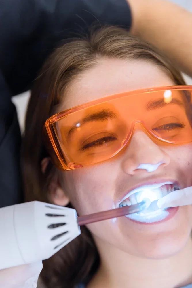 Teeth Whitening