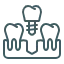 Dental implant icon