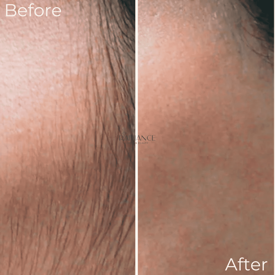 radiance-before-and-afters-2.png