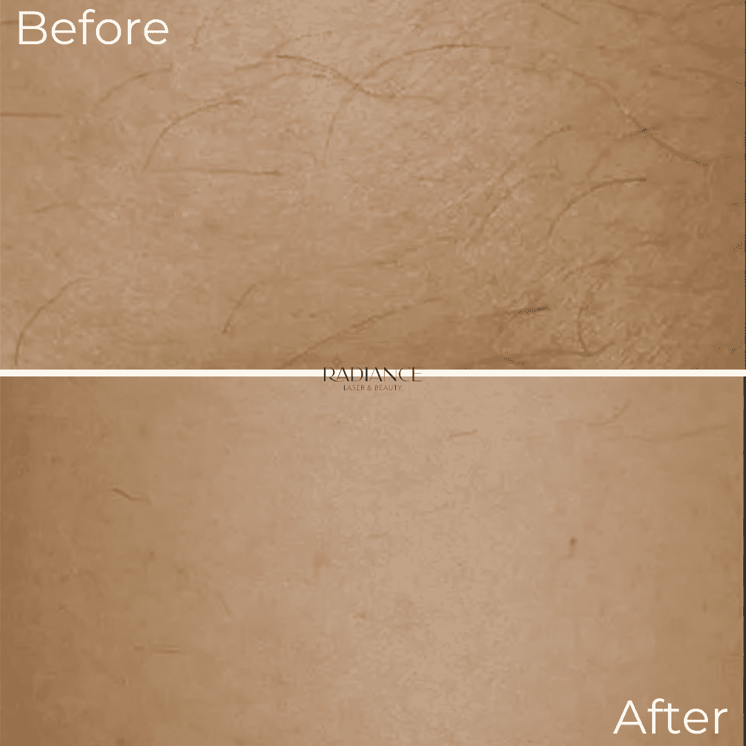 radiance-before-and-afters-1.png