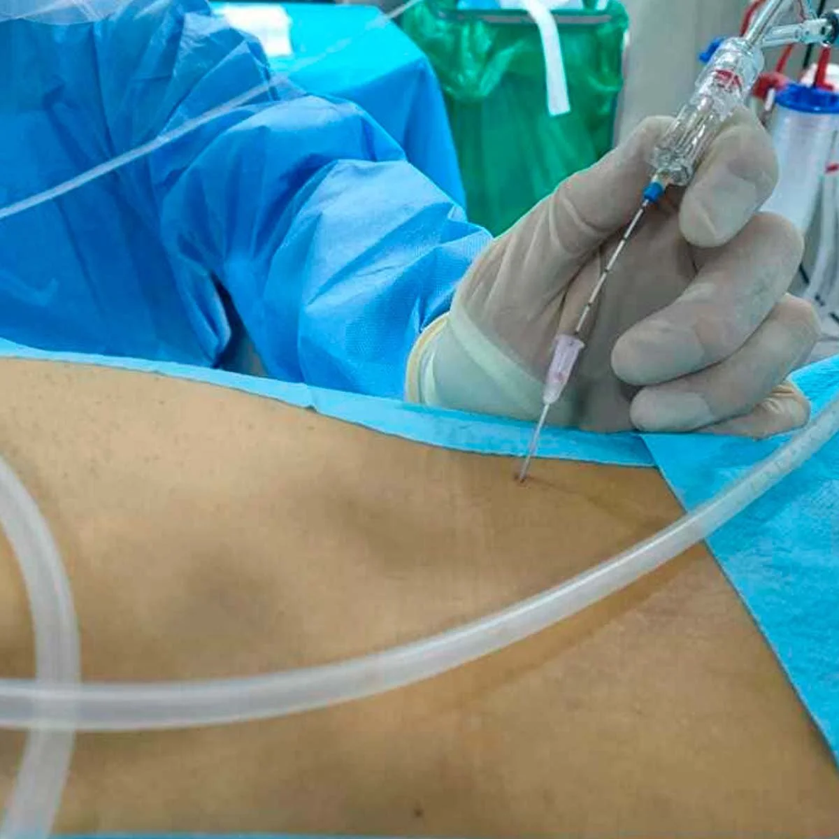 Hernia de disco sin cirugía