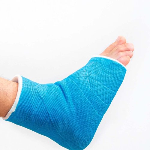 Fracturas en general