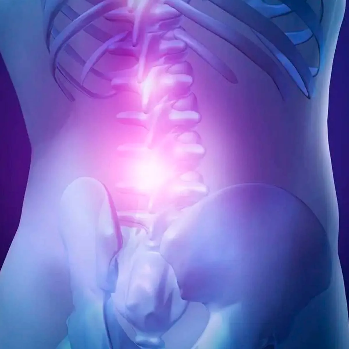Canal lumbar estrecho