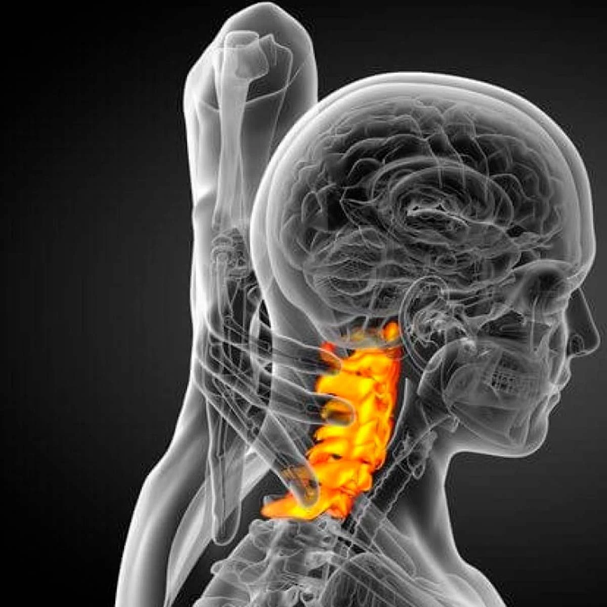Canal cervical estrecho