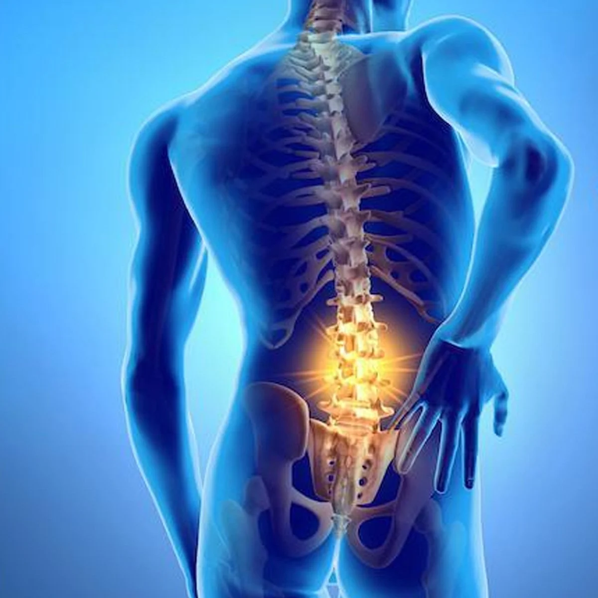 Hernia de Disco: Causas, Síntomas y Tratamientos