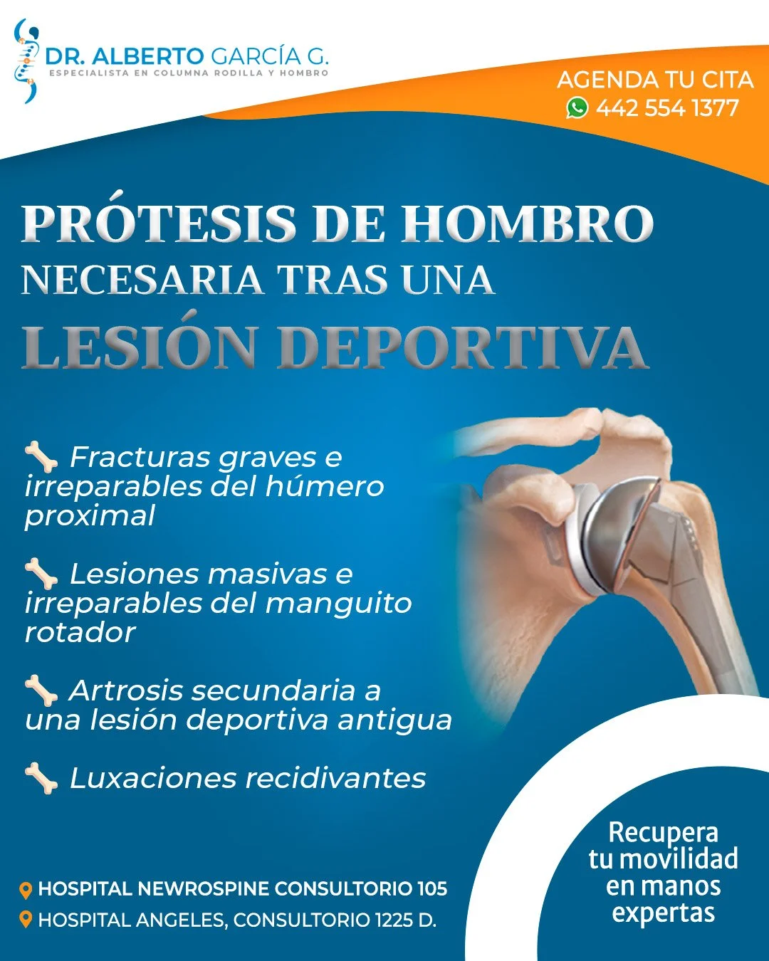💪 Muchas lesiones deportivas en el hombro pueden recuperarse con tratamiento y rehabilitaci&oacute;n&hellip; pero en algunos casos, cuando el da&ntilde;o es severo, una pr&oacute;tesis de hombro puede ser la mejor opci&oacute;n para recuperar movili