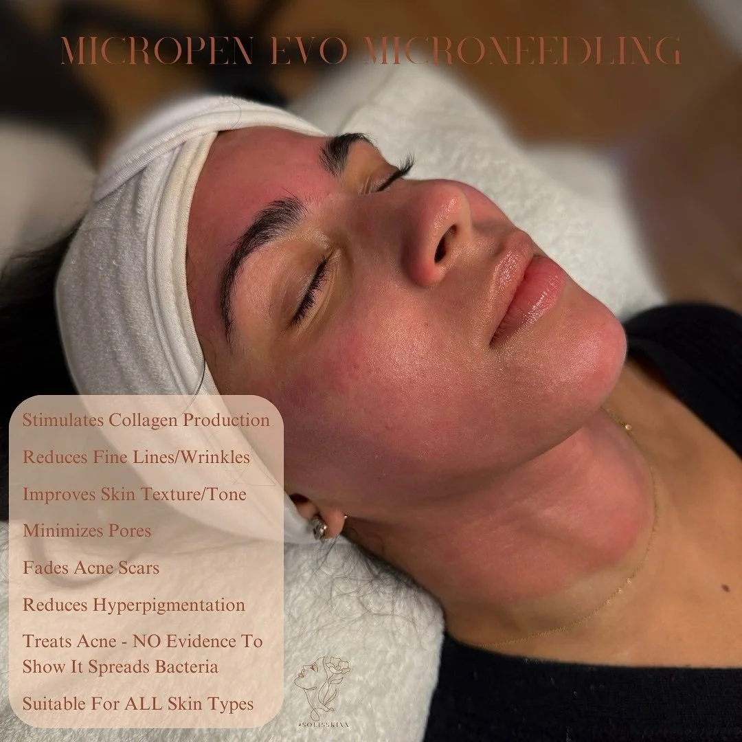 Microneedling with the MicroPen EVO is a game-changer for skin rejuvenation and acne treatment. By creating controlled microchannels in the skin, it stimulates collagen production, reduces acne scars, minimizes pores, and improves skin texture and to