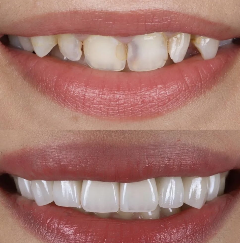 Screenshot 2026-01-12 at 19.16.24.png