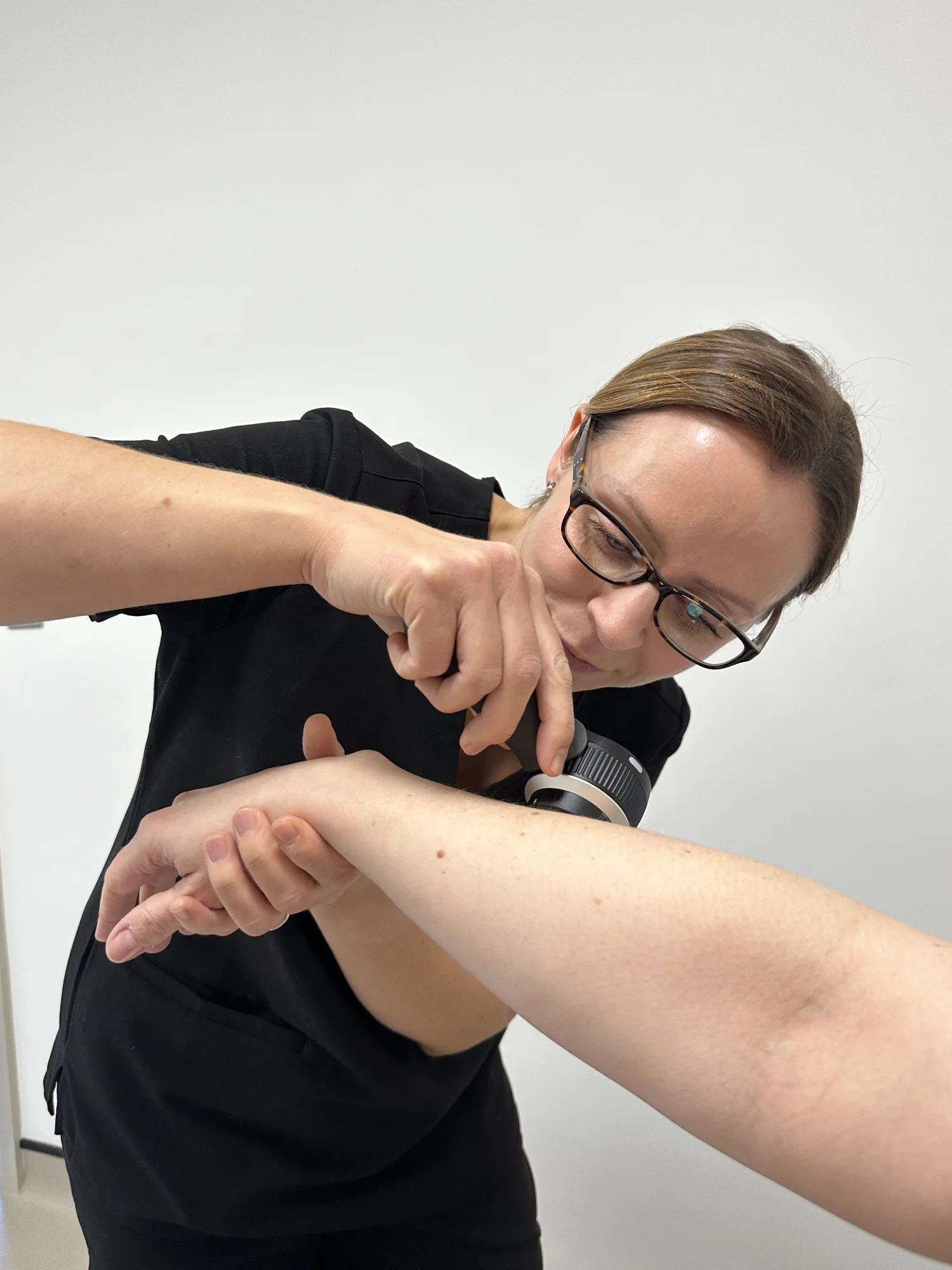 Singular Mole/Lesion Check — The York Skin Clinic