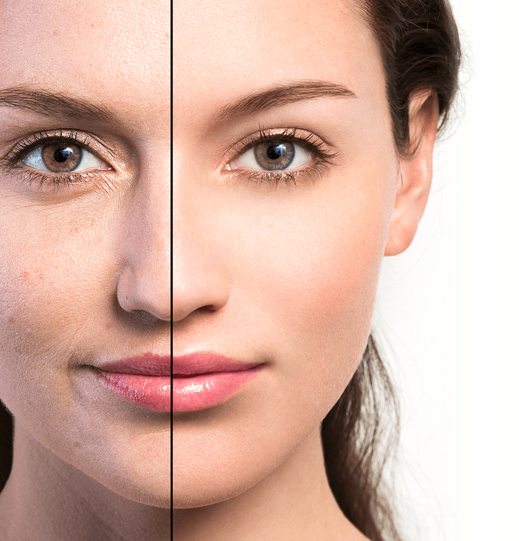 A side-by-side comparison showing the same woman with makeup on one side and no makeup on the other.