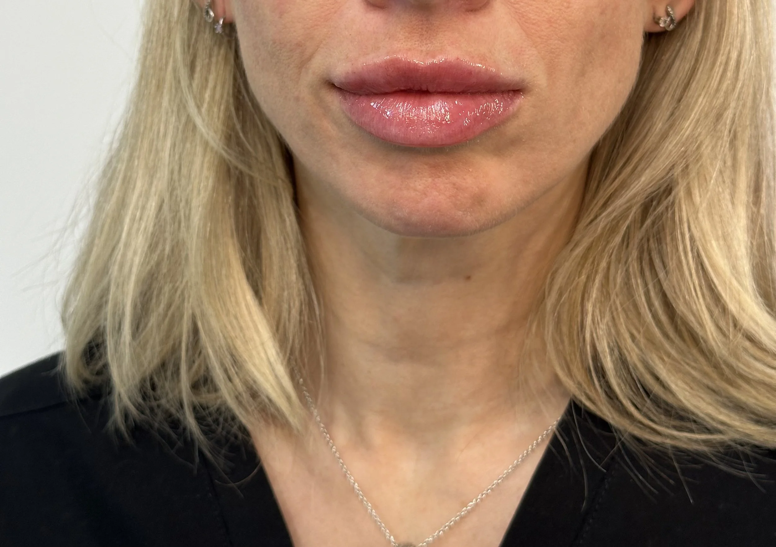 Close-up of a woman's lower face showing her lips with glossy pink lipstick, blonde hair, earrings, and a delicate necklace.