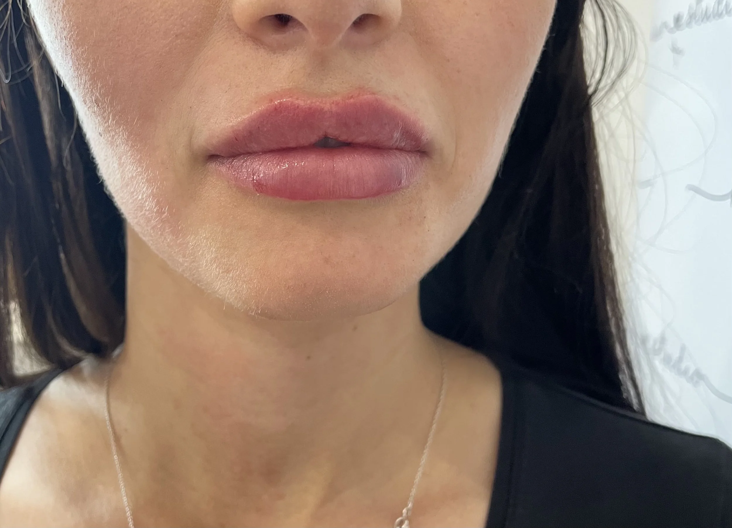 Close-up of a woman's lower face, showing her lips, chin, and part of her neck. She has pink lipstick, smooth skin, and dark hair, wearing a black top and a delicate silver necklace.
