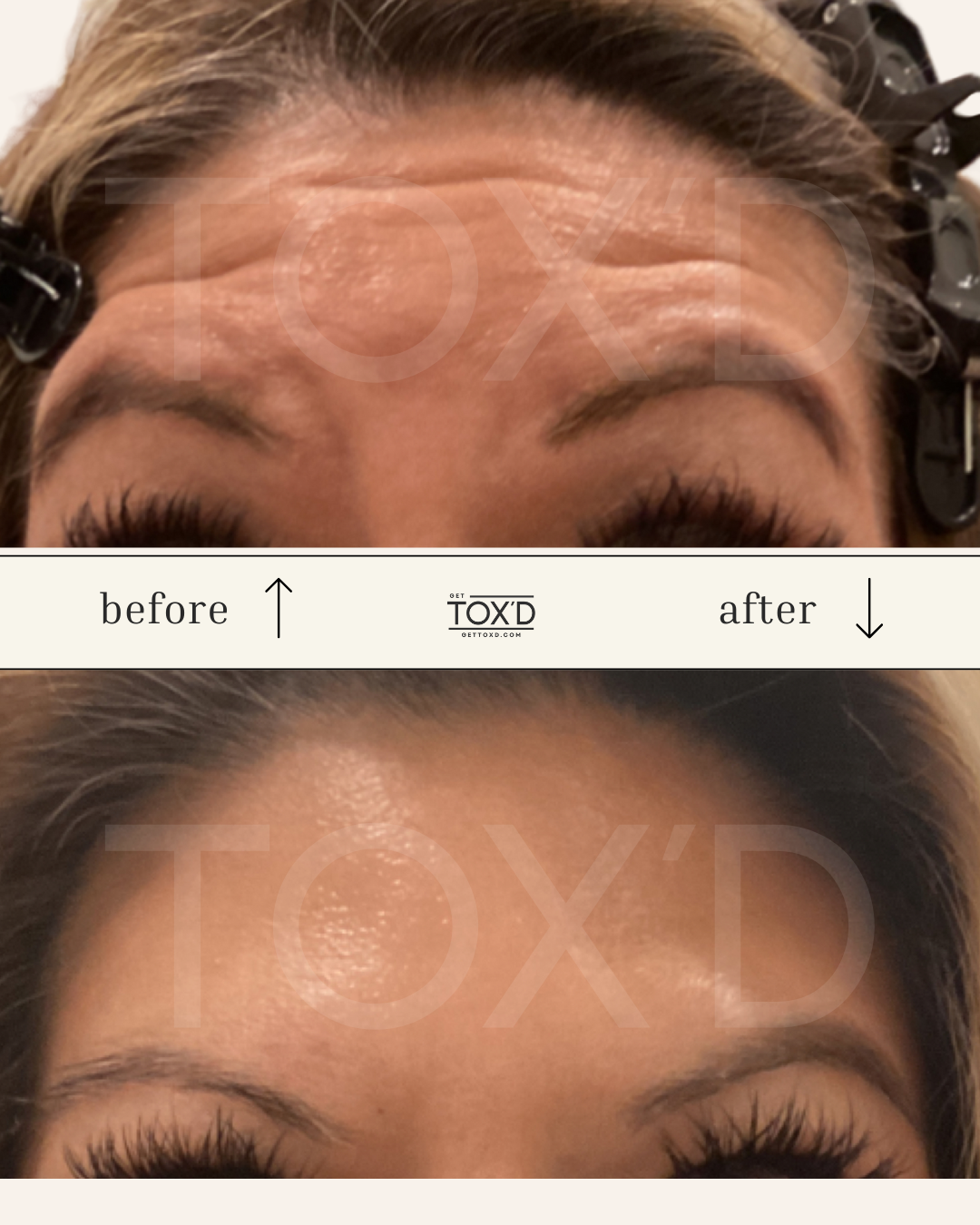 Tox’d (59).png