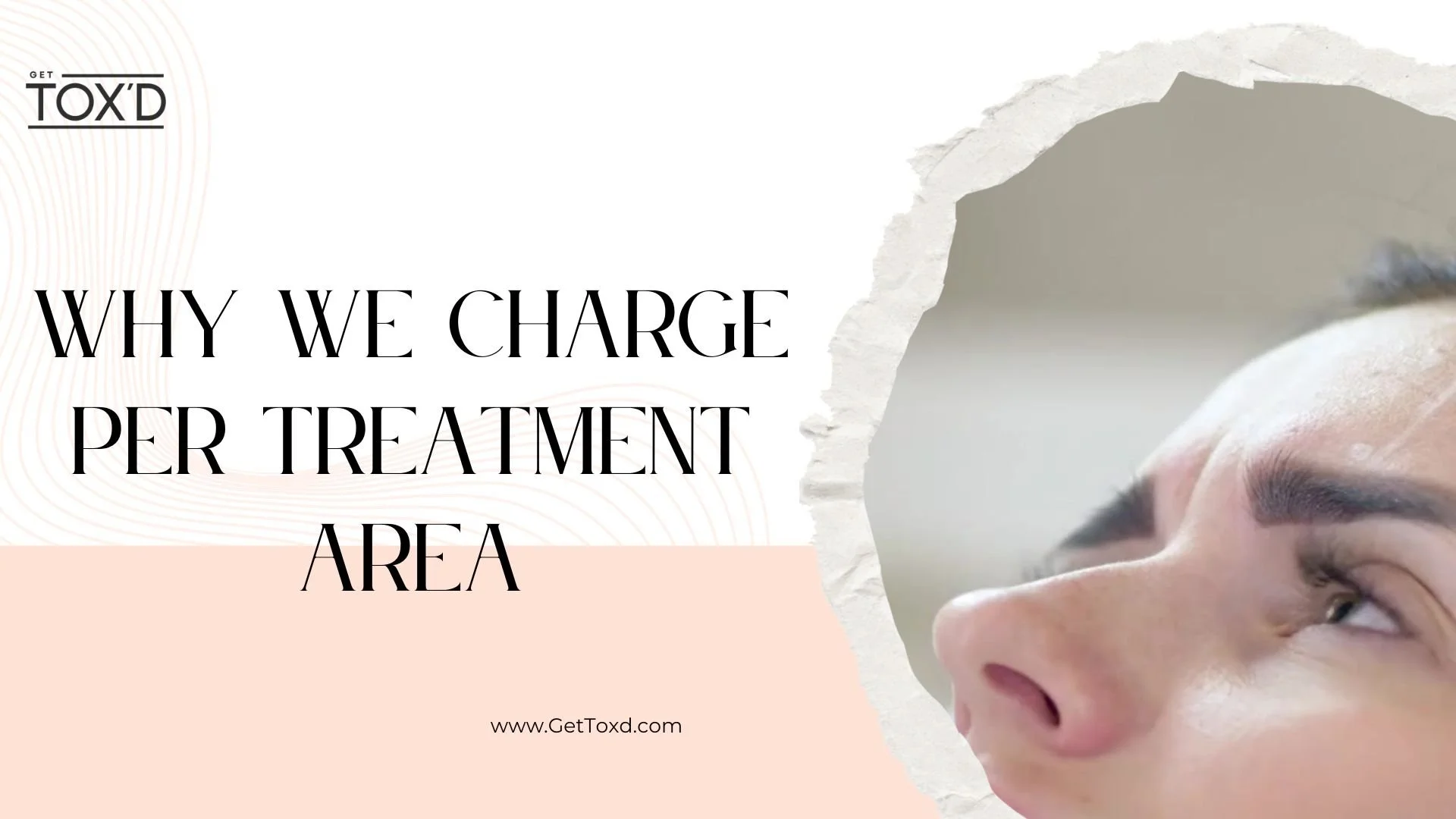 Botox Pricing Explained: Why We Charge Per Treatment Area